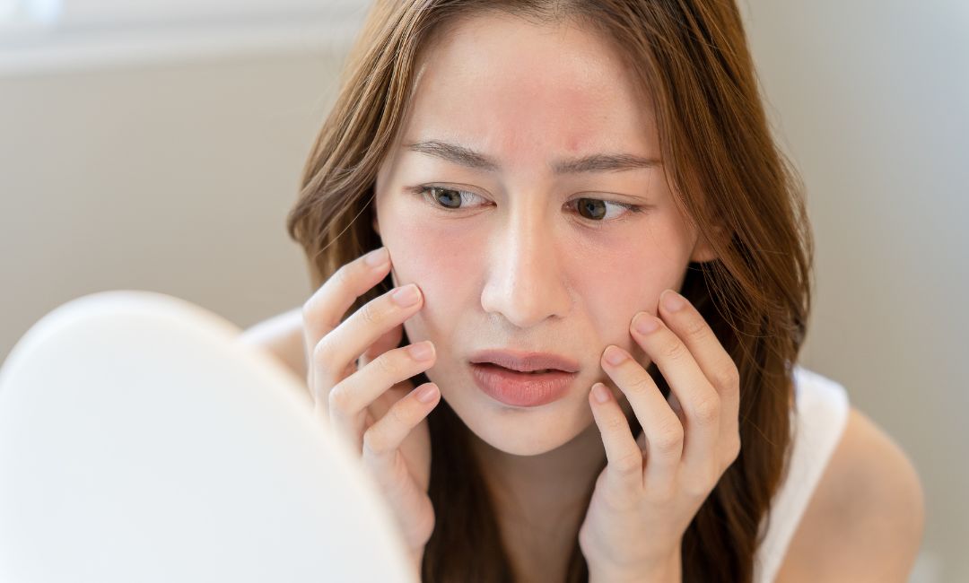 Soluciones para pieles sensibles: las mejores cremas faciales para cutis delicados