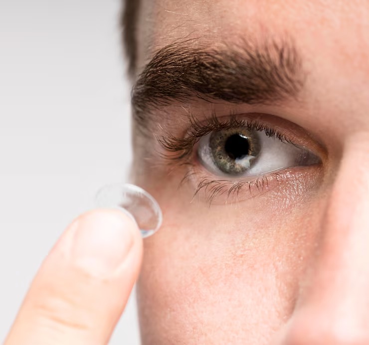 Why Your Contact Lenses May Be Causing Discomfort and How Mississauga Optometrists Can Help