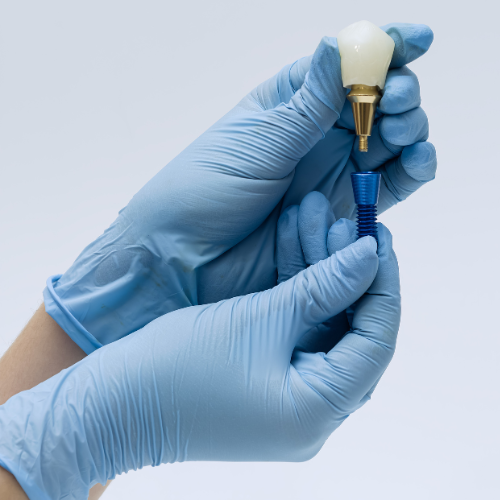 dental implants bella vista