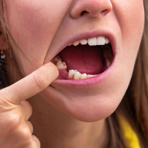 affordable dental implants near me
