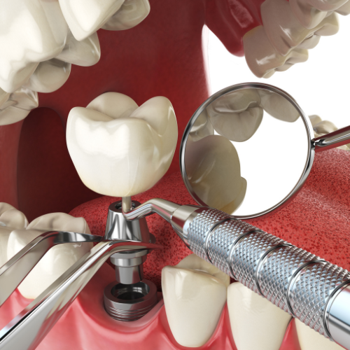 restorative dentistry